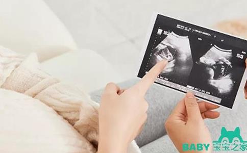 孕期指南：大排畸和小排畸的区别