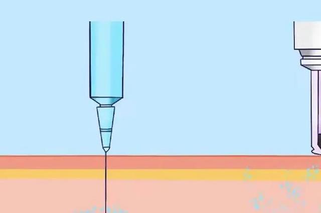 热点讯息：生长激素多少钱一针？一万一厘米