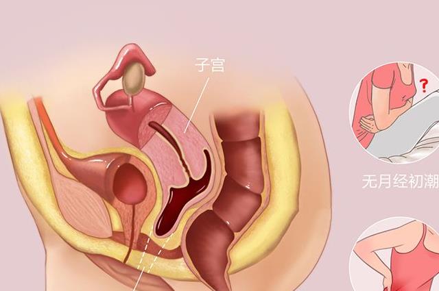 2022辽宁治疗幼稚子宫大概需要多少钱？准备5万够不够