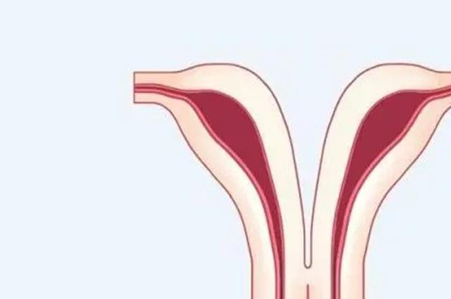 单角子宫可以承受几斤胎儿？看完心中就有数了