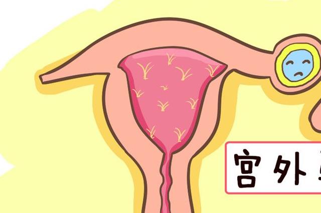 宫外怀孕有哪些前兆，在身体出现这4个症状时一定要引起重视