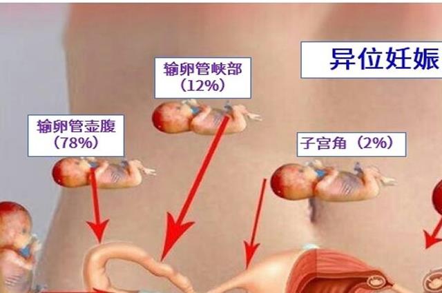 子宫图片