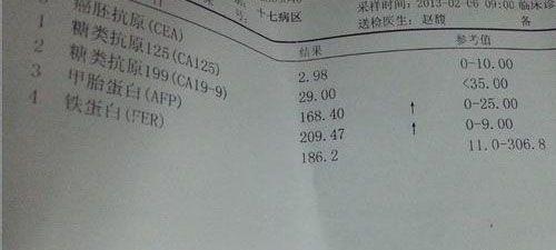 糖类抗原199正常值分享：高出25不严重