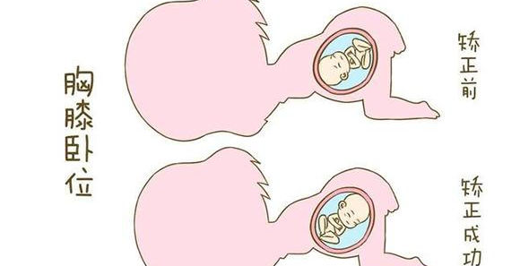 孕妇能感觉到胎儿在转头位时是慢慢转的吗？