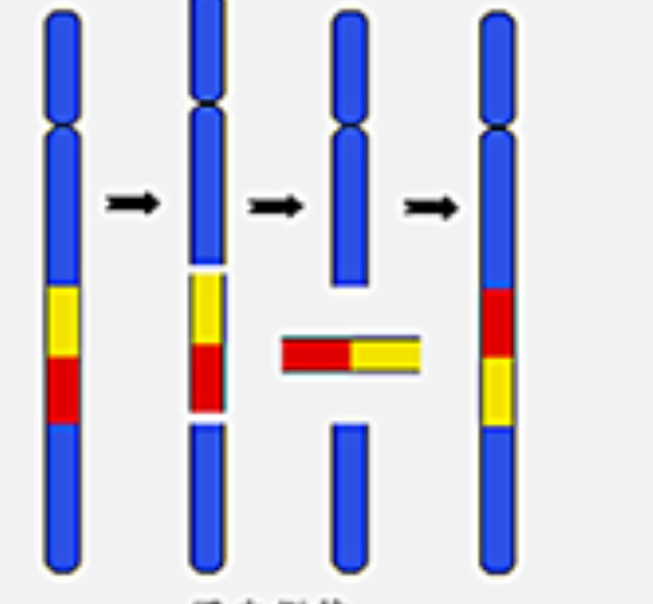 染色体臂间倒位对生育影响大，4种常见异常不可不知