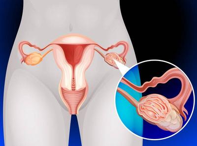 宫颈癌化疗后的反应，子宫孕二月大宫颈肥大要紧吗